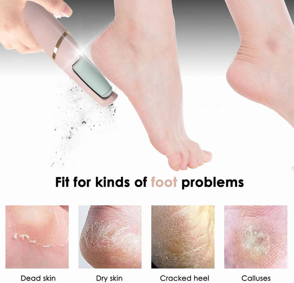 Electric Foot Grinder - Removes Hard & Dead Skin